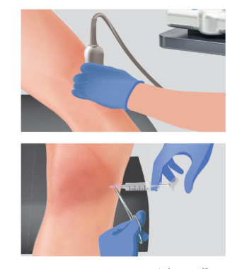 Procedure Performed