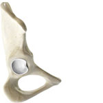 Hip Labral Tear