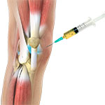 Orthobiologics for the Knee