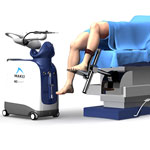 Robotic Assisted Knee Replacement